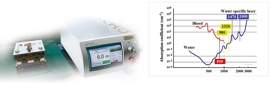 MÁY ĐIỀU TRỊ SUY GIÃN TĨNH MẠCH CHI DƯỚI LASER ATOVEN 1470NM
